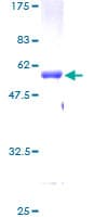 Human IGFBP6 Protein (Recombinant GST)
