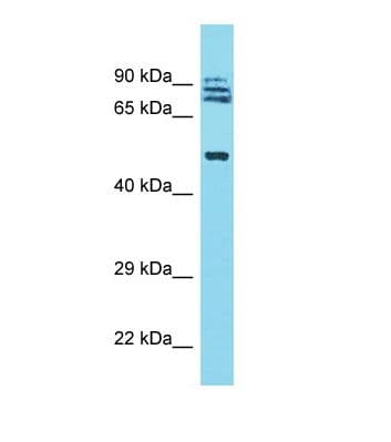 Polyclonal Rabbit anti-Human TRIM64 Antibody (aa61-110, WB)