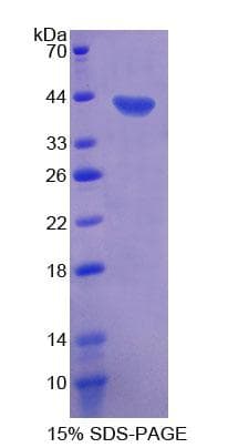 Human CD9 Protein (Recombinant His-GST)