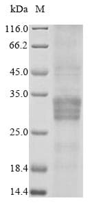 Rat OSM / Oncostatin M Protein (Recombinant 10His, N-terminus)