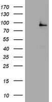 NBN / Nibrin Antibody (clone OTI2E9)
