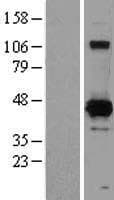 XRCC4 Protein (Over-Expression Lysate Myc-DDK (Flag))