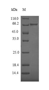 Cupressus arizonica PLY1 / Pectate lyase 1 Protein (Recombinant 10His, N-terminus + Myc, C-terminus)