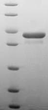 Human PDXK / PNK Protein (Recombinant GST, N-terminus)