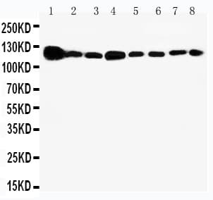 Polyclonal Rabbit anti-Human VCL / Vinculin Antibody (aa173-188, IHC, WB)
