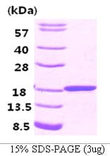Human FABP3 / H-FABP Protein (Recombinant His)