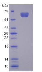 Mouse NUAK1 / ARK5 Protein (Recombinant His-GST)