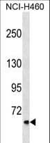 CLCNKA Antibody (aa20-47)
