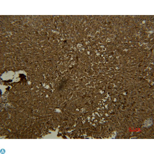 Monoclonal Mouse anti-Human TF / Transferrin Antibody (IHC)