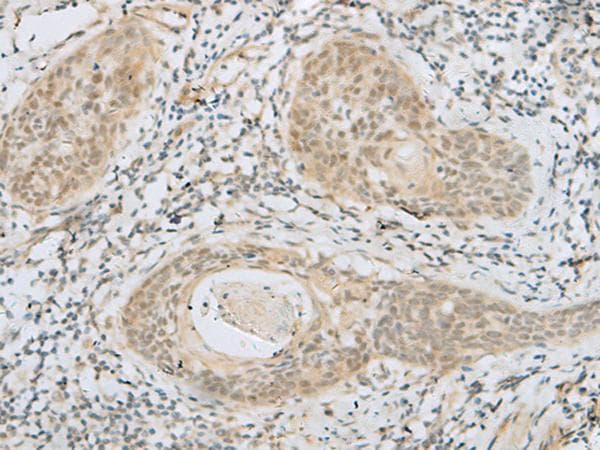 Polyclonal Rabbit anti-Human HELT Antibody (IHC)
