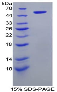 Rat SLC27A5 / BACS Protein (Recombinant His-GST)