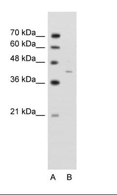 Polyclonal Rabbit anti-Human GNAS Antibody (aa297-346, WB)