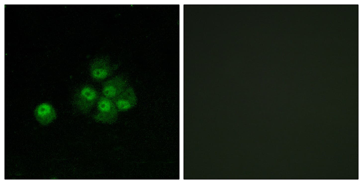 Polyclonal Rabbit anti-Human IRS1 Antibody (phospho-Ser636, IHC, IF, WB)