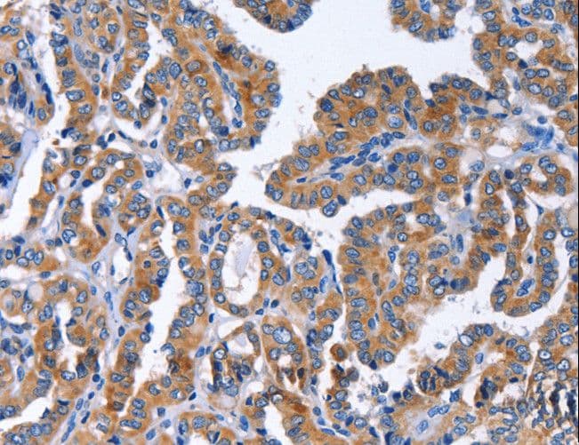 Polyclonal Rabbit anti-Human IGSF10 Antibody (IHC)
