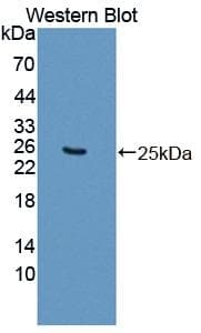 SDHB Antibody (aa97-282)