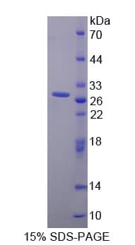 Bovine PRLR / Prolactin Receptor Protein (Recombinant His-T7)