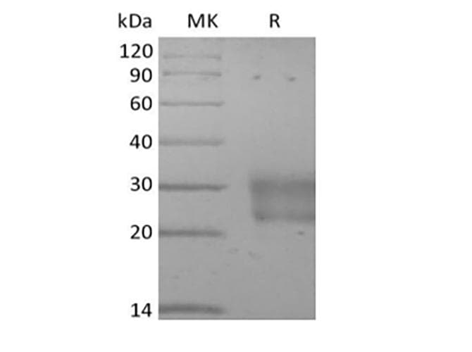 Human FZD8 / Frizzled 8 Protein (Recombinant 6His, C-terminus)