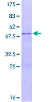 Human GSTM1 Protein (Recombinant GST)