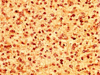 HIST1H1C Antibody
