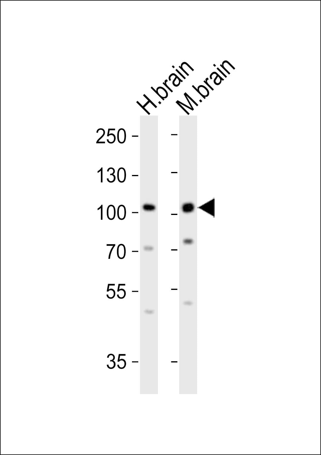 Polyclonal Rabbit anti-Mouse EPHA6 / EPH Receptor A6 Antibody (aa930-961, WB)