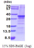 Human SNAI2 / SLUG Protein (Recombinant His)