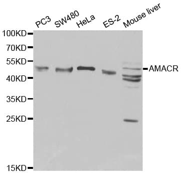 AMACR / P504S Antibody