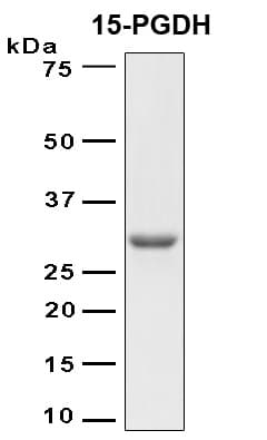 Human 15-PGDH / HPGD Protein (Recombinant 6His, N-terminus)