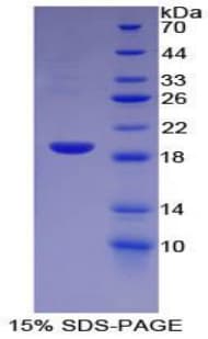 Mouse HBEGF / HB EGF Protein (Recombinant His-T7)