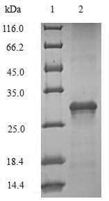 Mouse IL7R / CD127 Protein (Recombinant 6His-SUMO, N-terminus)