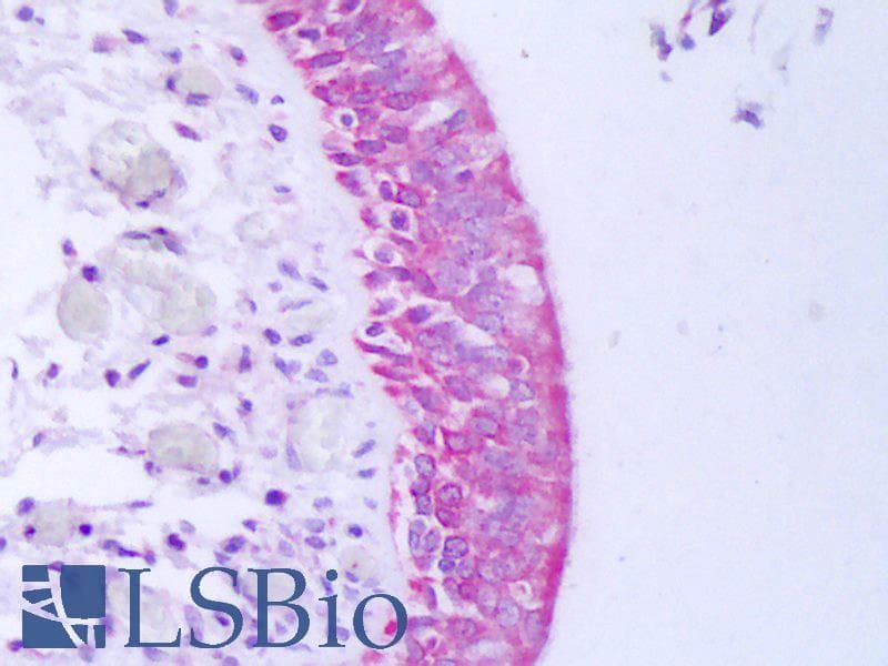 IHC-plus™ IFN Gamma / Interferon Gamma Antibody