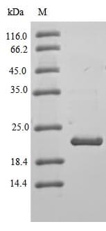 Human CLDN3 / Claudin 3 Protein (Recombinant 6His-B2M, N-terminus)