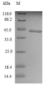 Mouse TLR7 / CD287 Protein (Recombinant 10His, N-terminus + Myc, C-terminus)