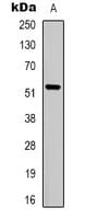 SLC16A12 / MCT12 Antibody (Internal)