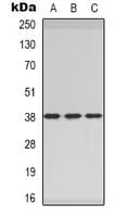 Polyclonal Rabbit anti-Human CER1 Antibody (Internal, IHC, WB)