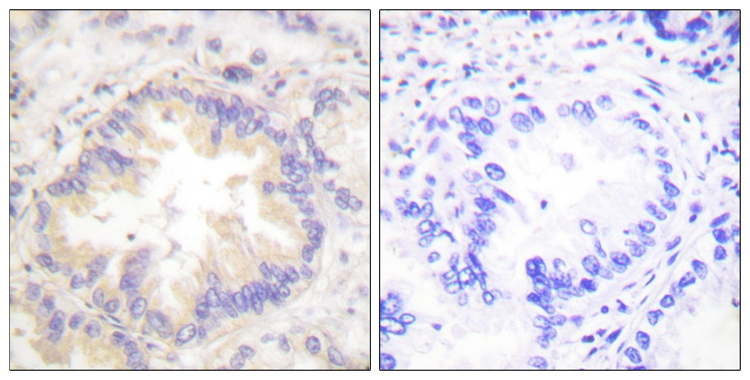 CASP9 / Caspase 9 Antibody (phospho-Thr125)