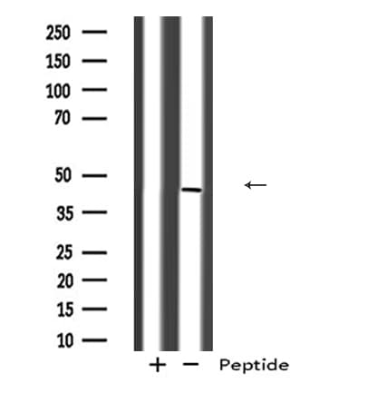 Polyclonal Rabbit anti-Human CYLC2 Antibody (IHC, WB)