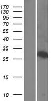 WSB1 Protein (Over-Expression Lysate Myc-DDK (Flag))
