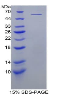 Mouse MYC / c-Myc Protein (Recombinant His-GST)