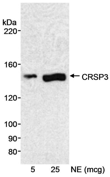 Polyclonal Rabbit anti-Human MED23 / SUR2 Antibody (aa1300-C-term, WB)