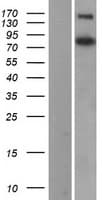 COL3A1 / Collagen III Protein (Over-Expression Lysate Myc-DDK (Flag))