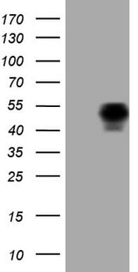 Monoclonal Mouse anti-Human PDCD1 / CD279 / PD-1 Antibody (clone OTI22A9, IF, WB)