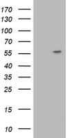 ATP6V1B1 Antibody (clone OTI3B11)