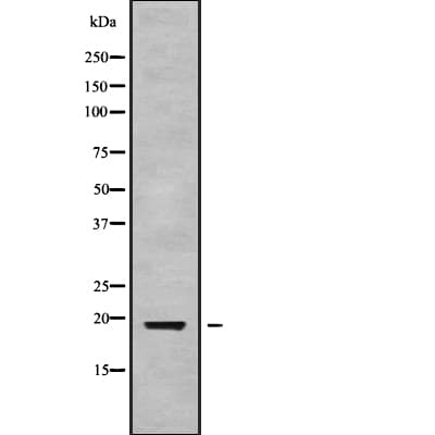RPS10 / Ribosomal Protein S10 Antibody