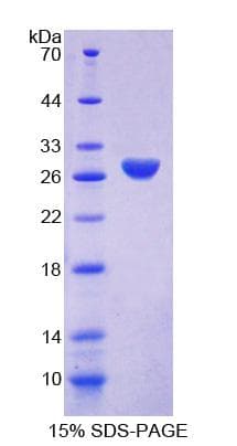 Rat AMPH / Amphiphysin Protein (Recombinant His-T7)
