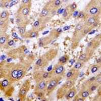 Polyclonal Rabbit anti-Human GPT / Alanine Transaminase Antibody (IHC, WB)