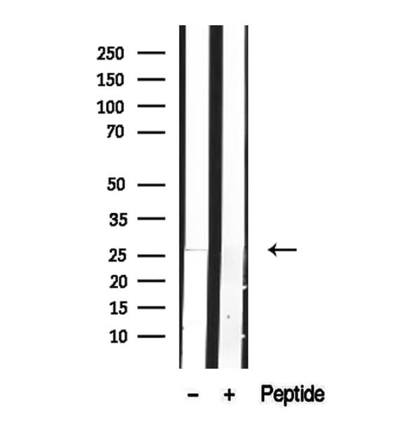 Polyclonal Rabbit anti-Human DCTN6 / Dynactin 6 Antibody (IHC, IF, WB)
