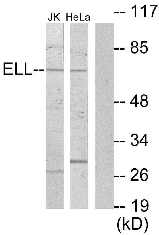 ELL / MEN Antibody