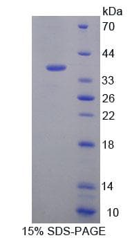 Human EEF1D Protein (Recombinant His-T7, N-terminus)