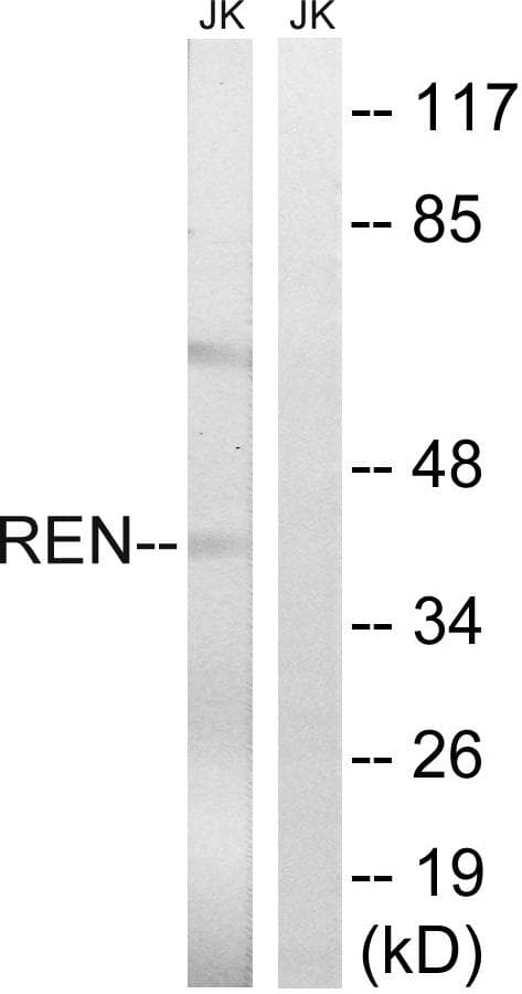 Polyclonal Rabbit anti-Human REN / Renin 1 Antibody (WB)