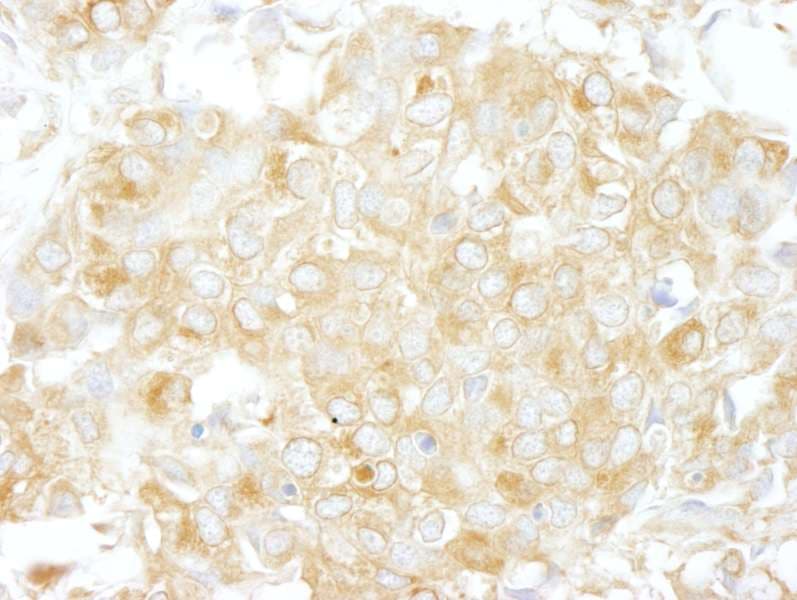 ARHGAP1 / CDC42GAP Antibody (aa1-50)